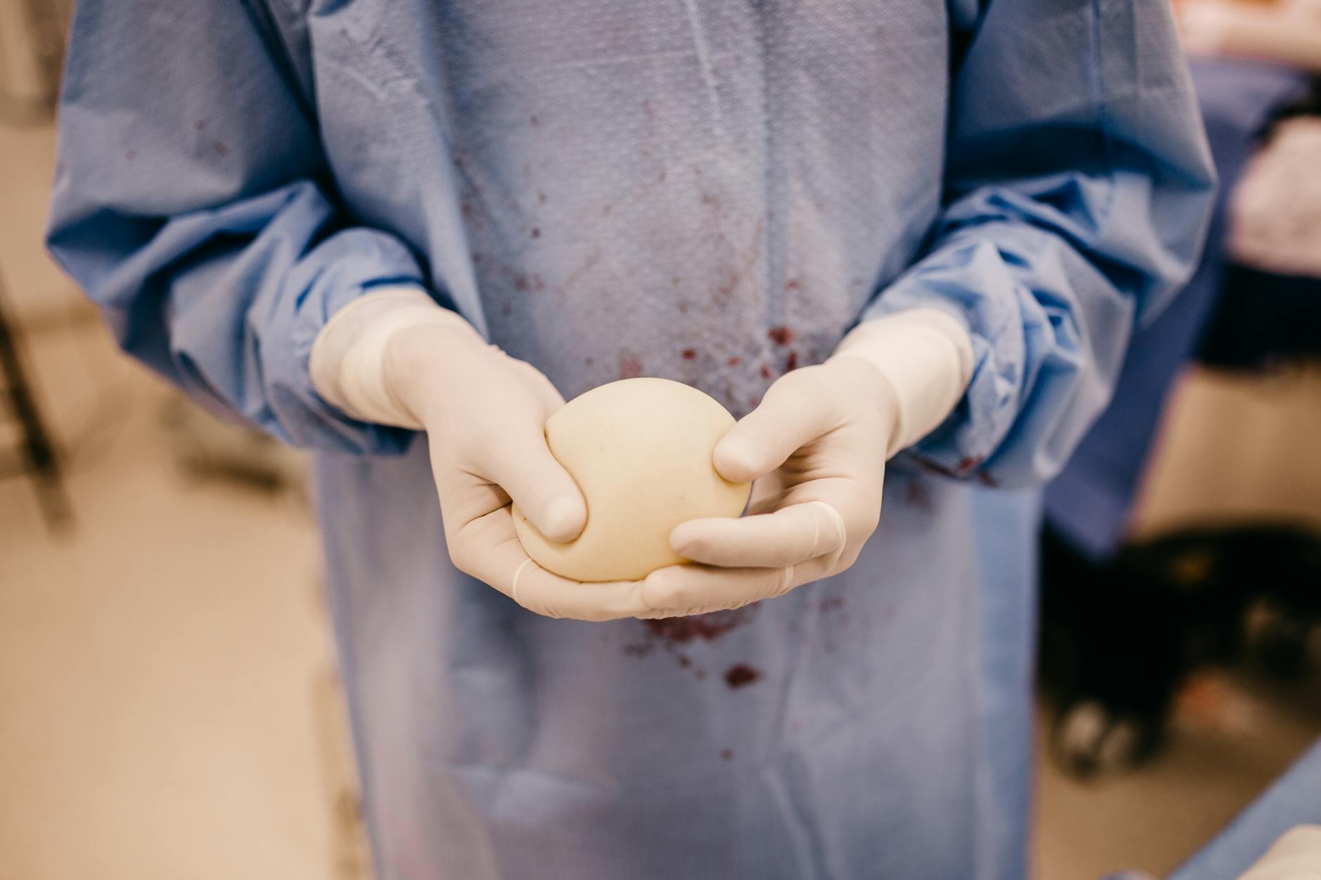Close-up of a surgeon holding a silicone implant prepared for surgery.